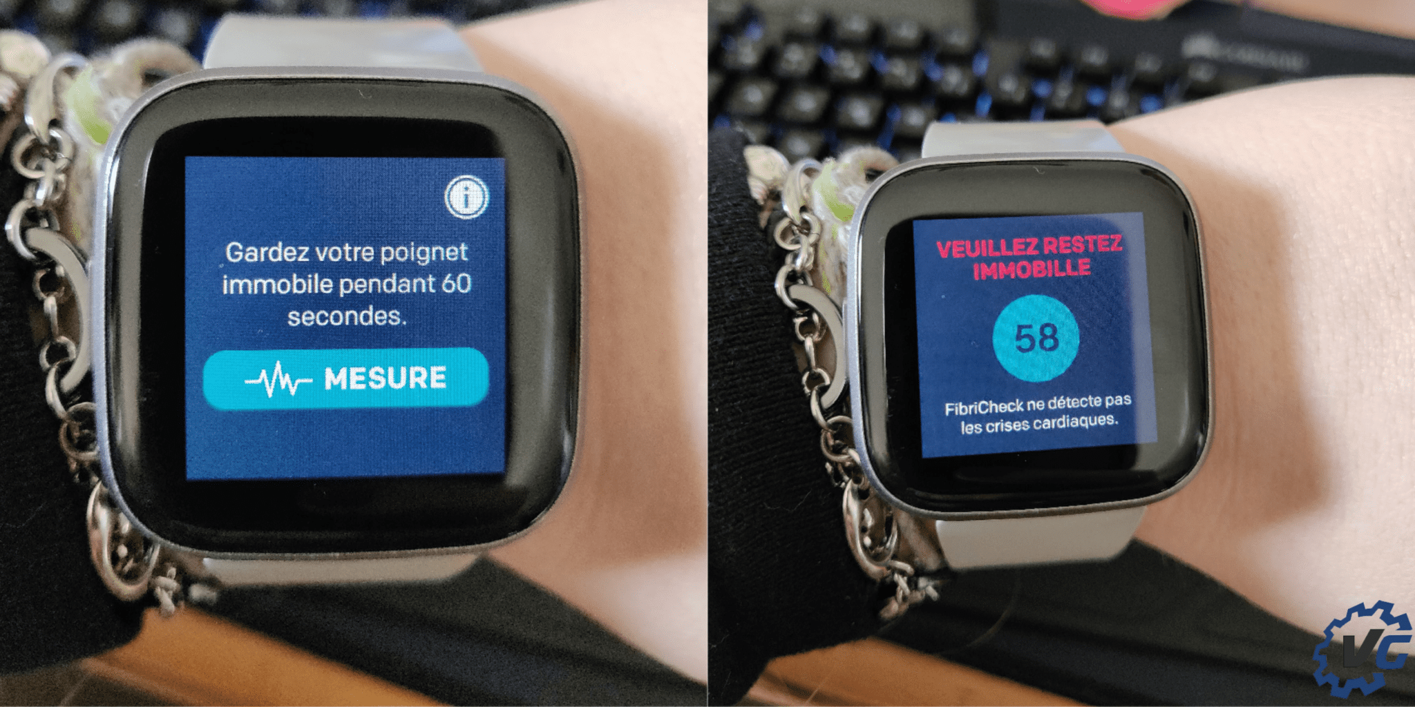FibriCheck Fitbit pour détecter les troubles du rythme cardiaque